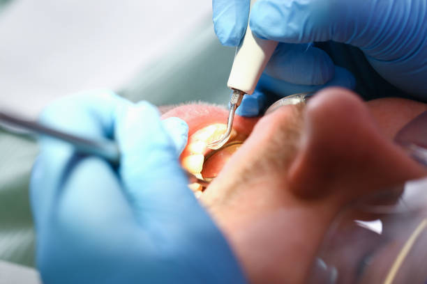 Best Pediatric Emergency Dentist in Beecher, IL