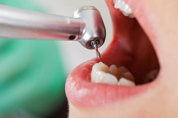 Best Emergency Tooth Extraction in Beecher, IL